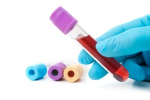 Supreme Court added safeguards to DWI blood tests