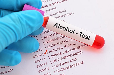 El Rol De Un Toxicologo En Tu Caso De DWI Es Importante En Tu Caso Legal De DWI